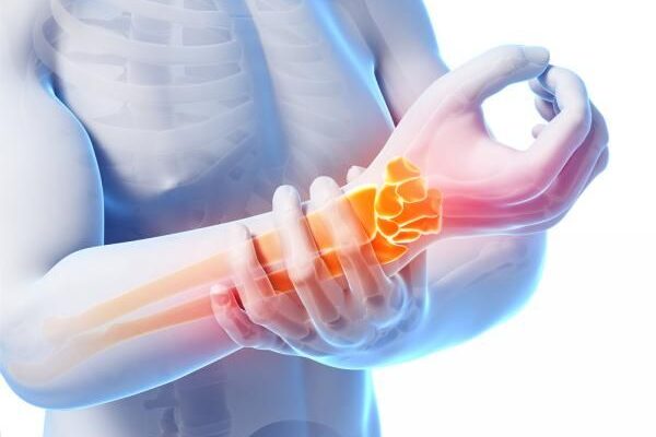 Arthritis Basics: What It Is and How to Treat It