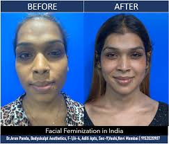 The Ultimate Guide to the Best Plastic Surgeons in India
