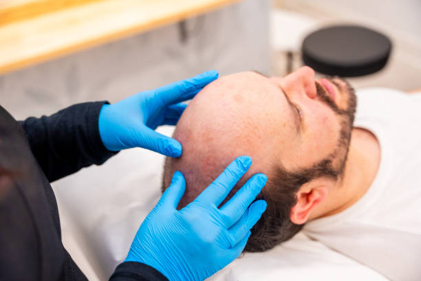 PRP Hair Treatment in Abu Dhabi